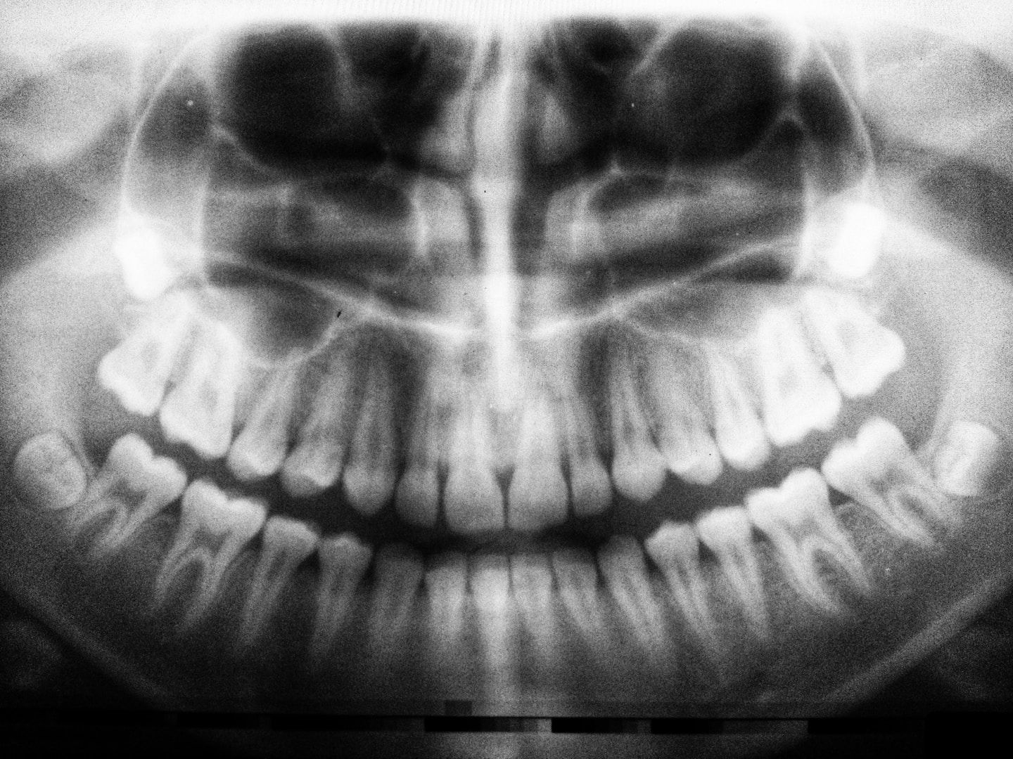 dental images